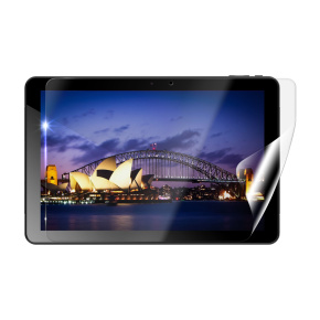 Screenshield IGET Smart L103 fólia na displej